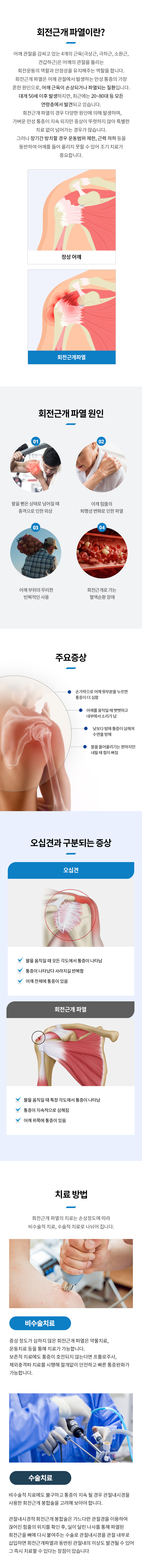 회전근개파열