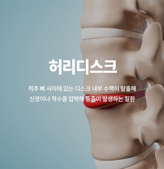 허리디스크