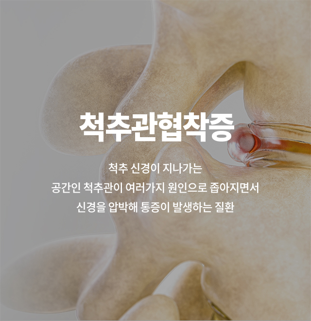 척추관협착증