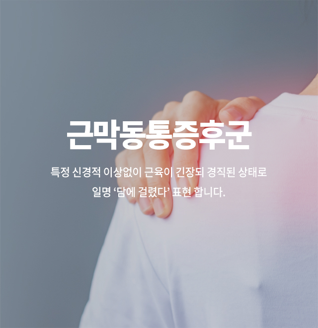 근막동통증후군